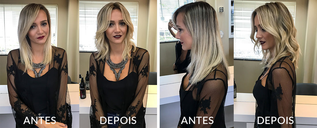 etapas4